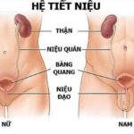 Tại sao